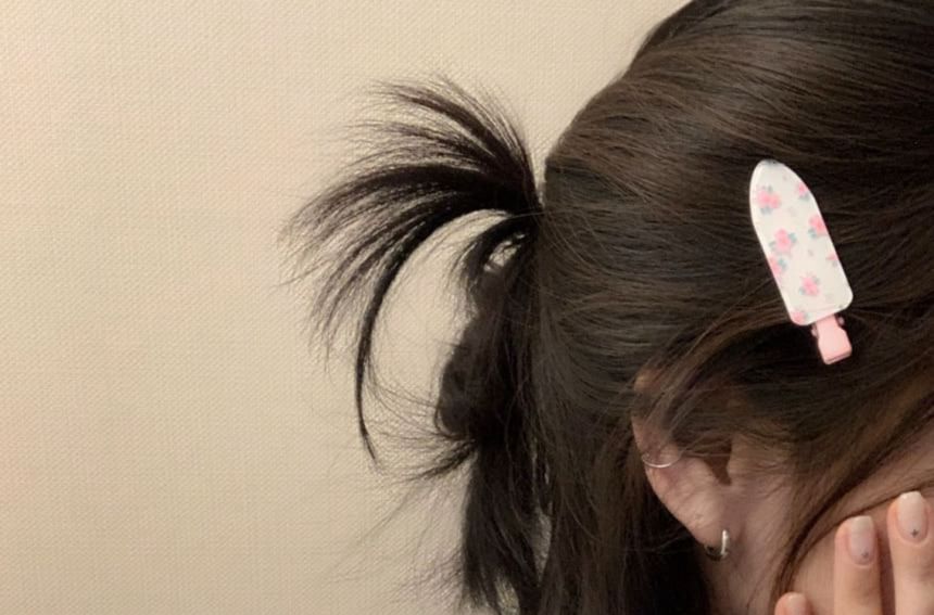 Patterned Hair Acrylic Clip Set of 2: